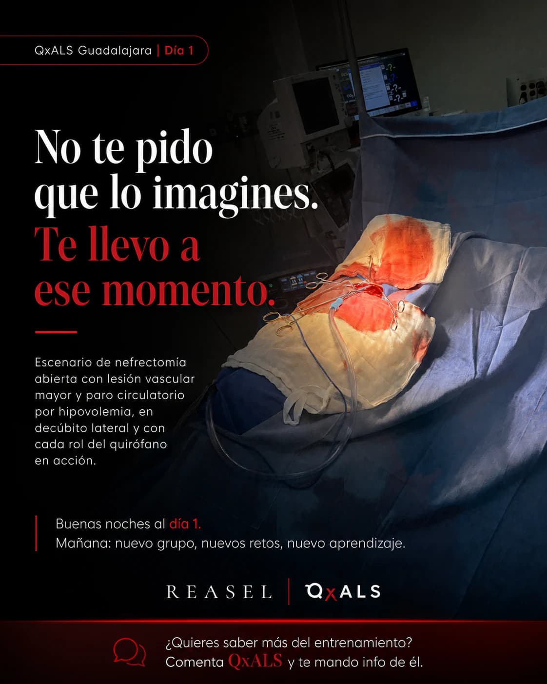 Simulador preparado para un escenario de nefrectomía con lesión vascular y paro circulatorio.
